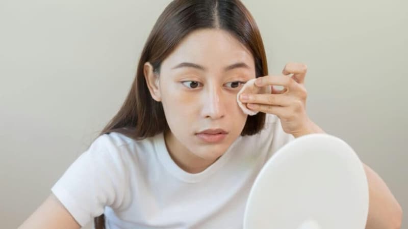 Hướng dẫn vệ sinh mí mắt đúng cách cho mắt khỏe và mắt bị viêm bờ mi