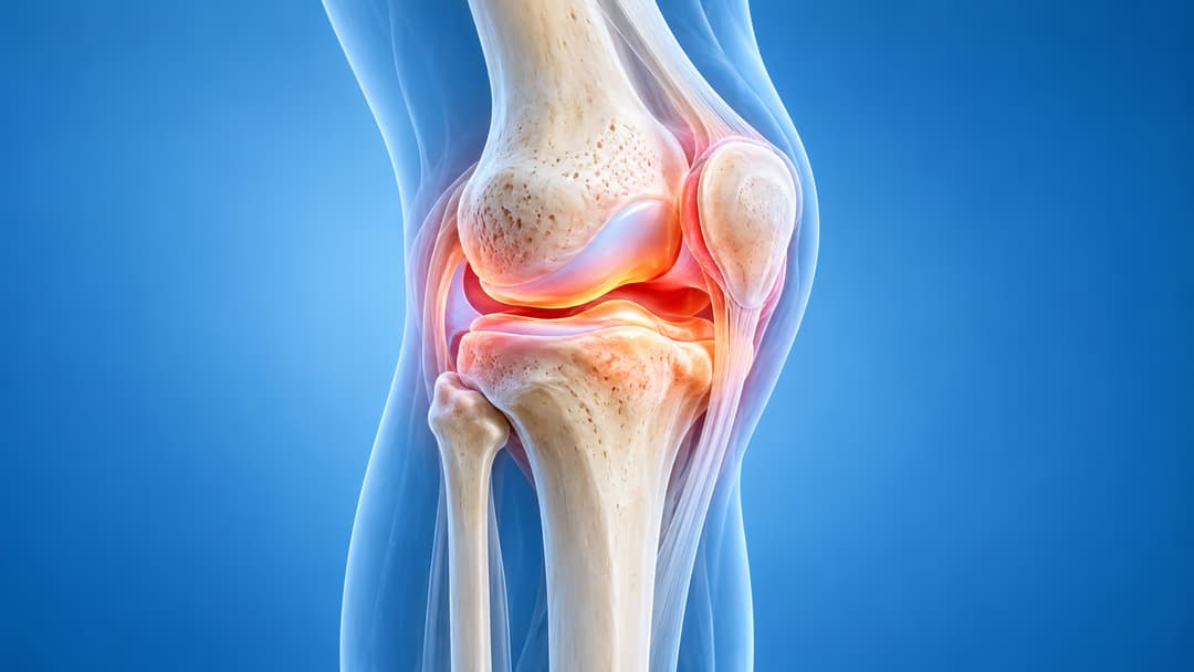 Viêm cơ đầu gối: Nguyên nhân phổ biến và giải pháp khắc phục