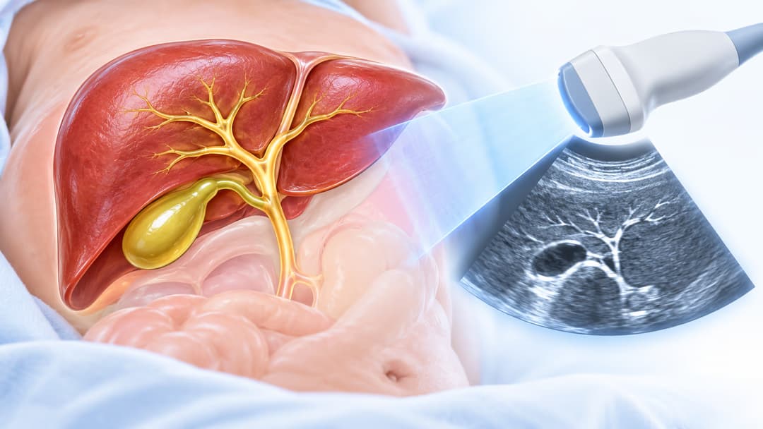 Các phương pháp chẩn đoán teo đường mật ở trẻ sơ sinh