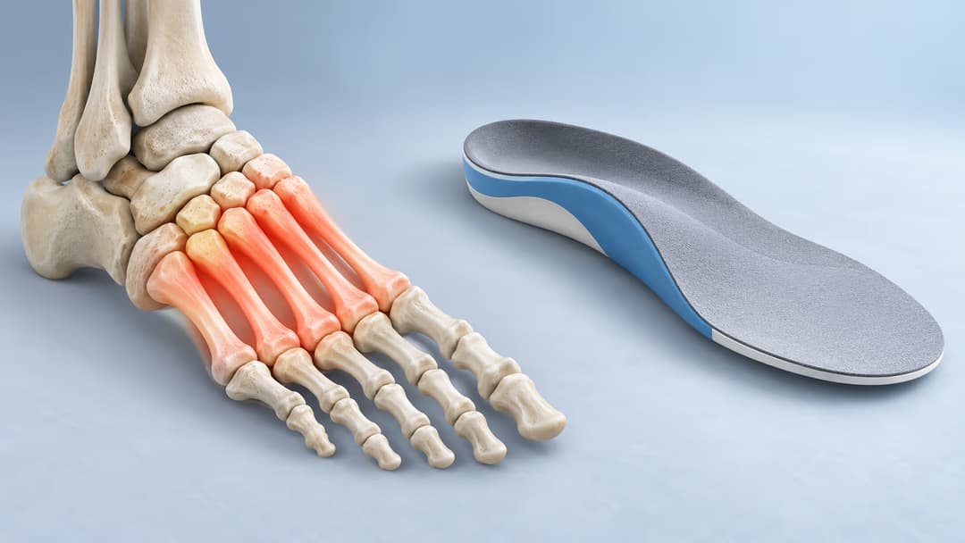 Đau xương đốt bàn chân: Nguyên nhân và các biện pháp cải thiện