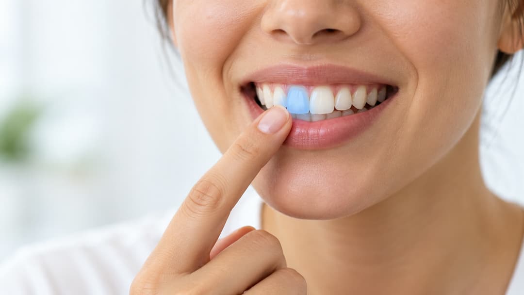 Bị ê buốt răng cửa phải làm sao và cách khắc phục