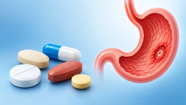 Các nhóm thuốc chữa viêm loét dạ dày thường dùng và lưu ý sử dụng
