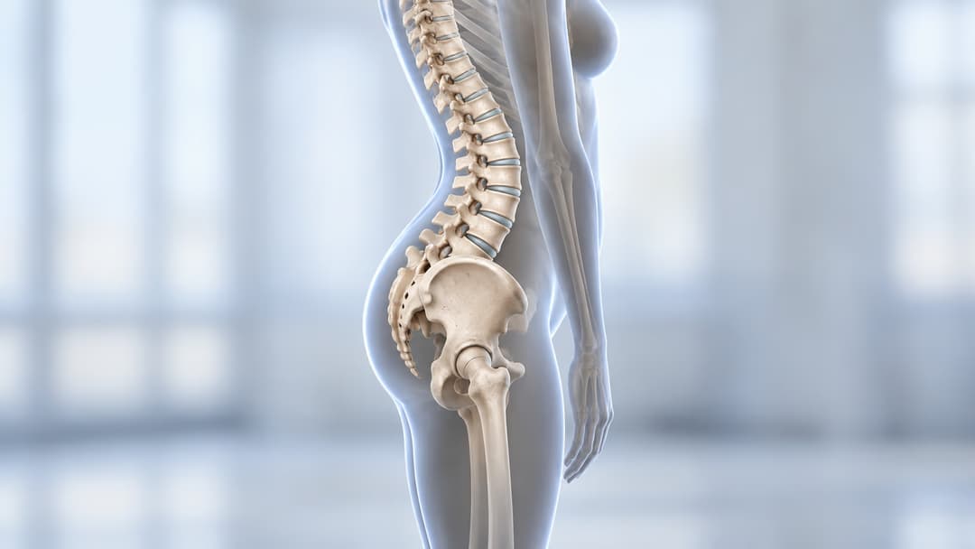 Bệnh võng lưng có chữa được không và cách cải thiện