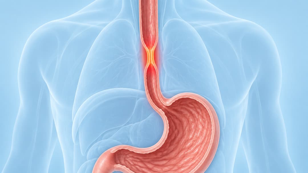 Hẹp thực quản: Nguyên nhân và cách điều trị