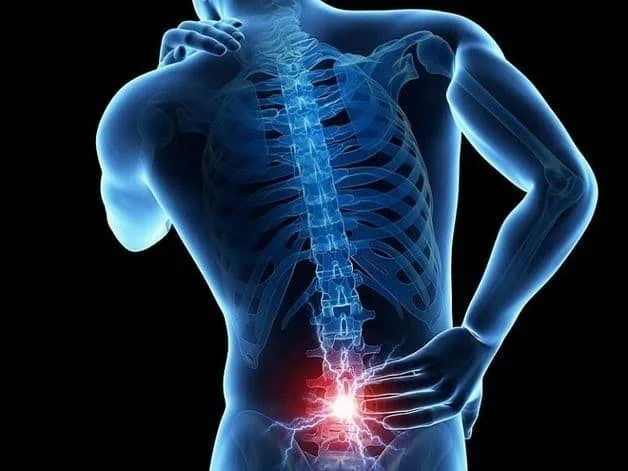 Hình ảnh mô phỏng cấu trúc xương bị loãng xương gây đau nhức cột sống ở nam giới