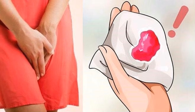 Minh họa sản phụ theo dõi lượng máu bất thường sau sinh trên băng vệ sinh