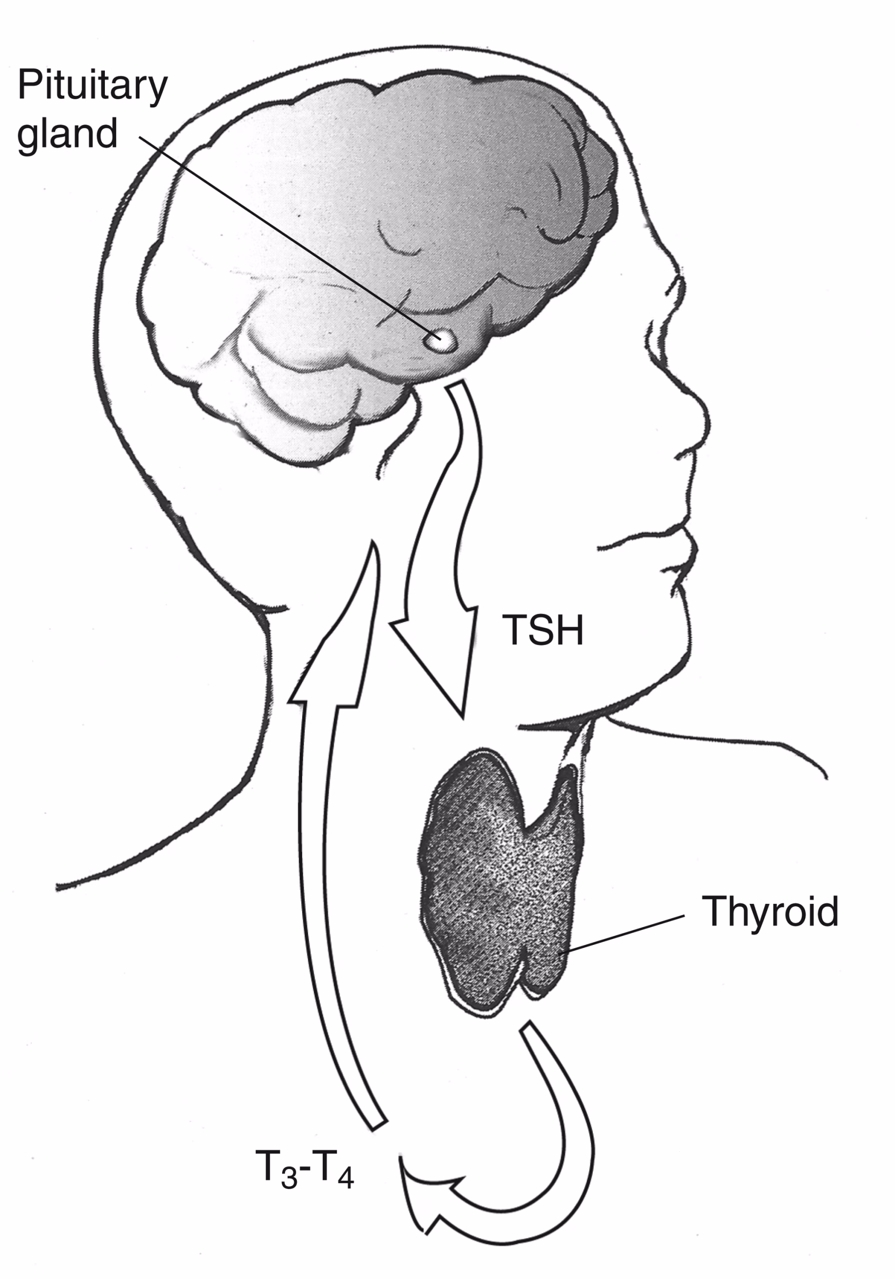 Hình minh họa tuyến giáp và hormone tuyến giáp liên quan bệnh Basedow