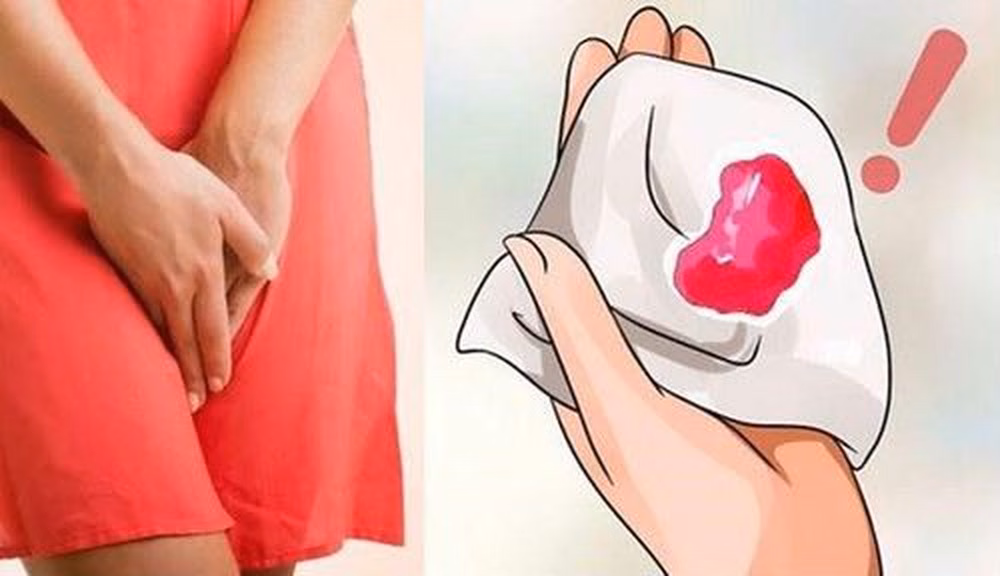 Minh họa lượng máu ra bất thường sau sinh cần được đánh giá y tế