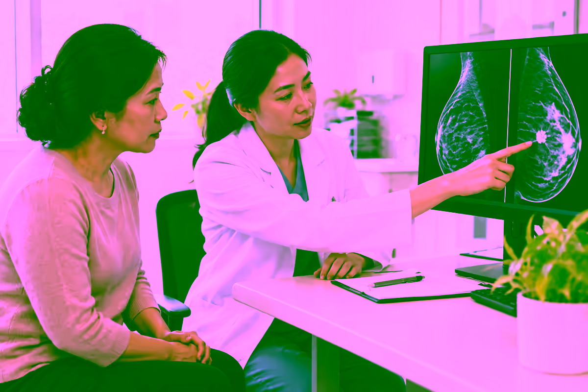 Ung thư biểu mô ống dẫn sữa tại chỗ được phát hiện qua chụp nhũ ảnh