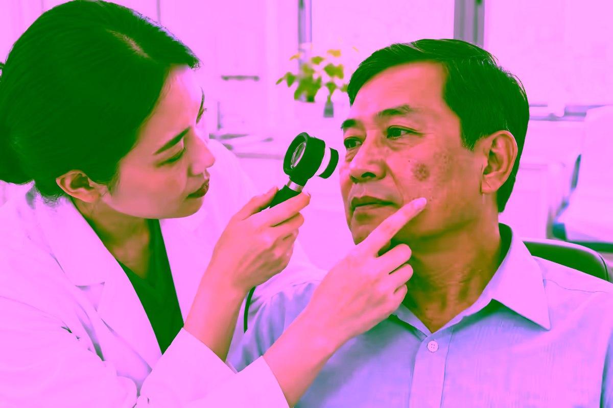 Bác sĩ da liễu kiểm tra tổn thương da nghi ung thư tế bào vảy