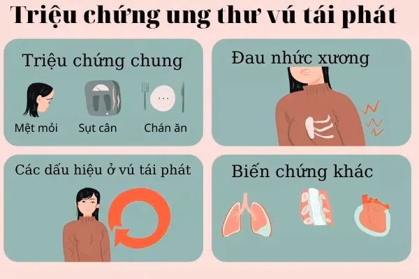 Bác sĩ chuyên khoa ung bướu thăm khám lâm sàng vùng ngực và sẹo mổ nhằm phát hiện sớm dấu hiệu ung thư vú tái phát