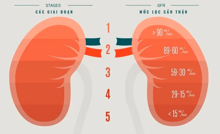 Bác sĩ chuyên khoa thận tư vấn về các giai đoạn suy giảm chức năng cầu thận cho người bệnh