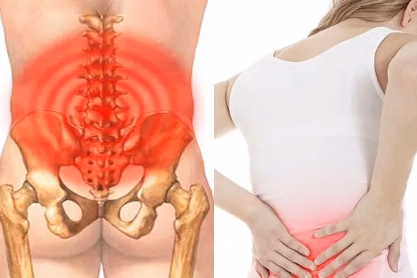 Minh họa vị trí tổn thương gây đau thắt lưng tại cột sống thắt lưng L1 đến L5