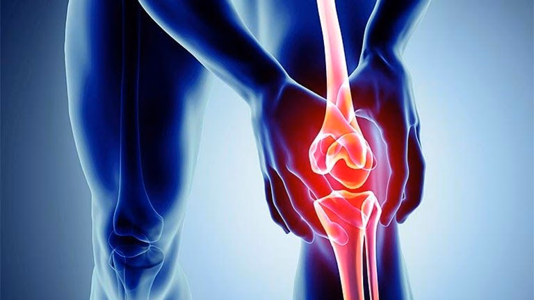 Minh họa vị trí đau khớp gối và phản ứng viêm sưng quanh cấu trúc khớp