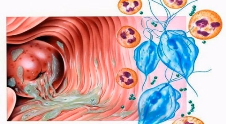 Hình ảnh minh họa cấu trúc trùng roi Trichomonas vaginalis gây viêm âm đạo dưới kính hiển vi