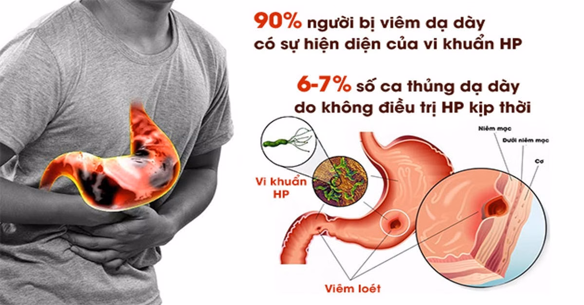 Hình thái vi khuẩn Helicobacter pylori dưới kính hiển vi với các lông roi đặc trưng giúp di chuyển trong lớp nhầy dạ dày