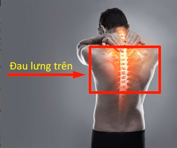 Hình ảnh minh họa vị trí đau lưng trên tại vùng cột sống ngực và khối cơ lưng sau vai