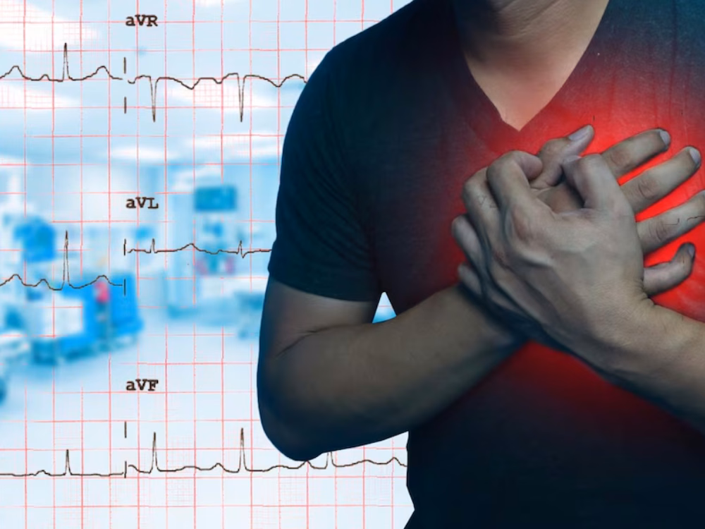 Cơn đau thắt ngực sau xương ức lan lên vai và cánh tay cảnh báo nhồi máu cơ tim cấp