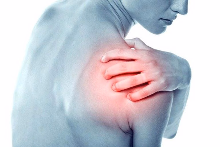Sơ đồ giải phẫu vị trí chỏm xương cánh tay trượt khỏi ổ chảo trong chấn thương trật khớp vai