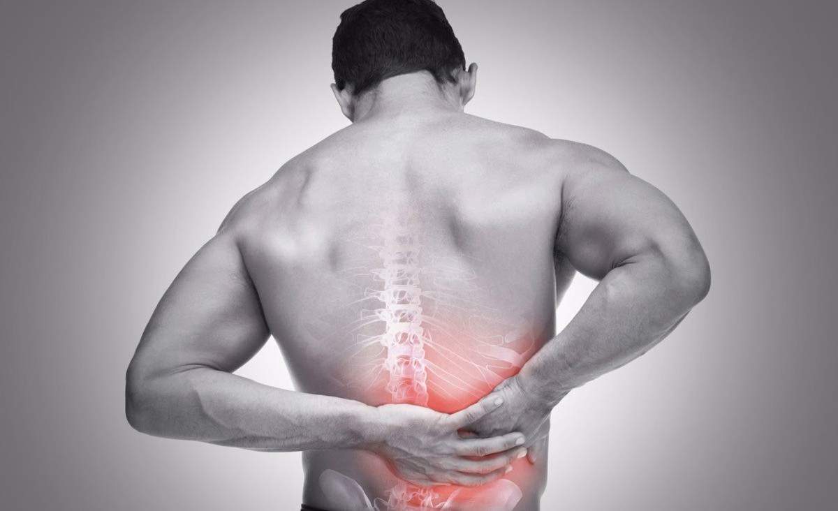 Hình ảnh mô phỏng vị trí đau nhức và phản ứng viêm dọc cột sống thắt lưng của người bệnh