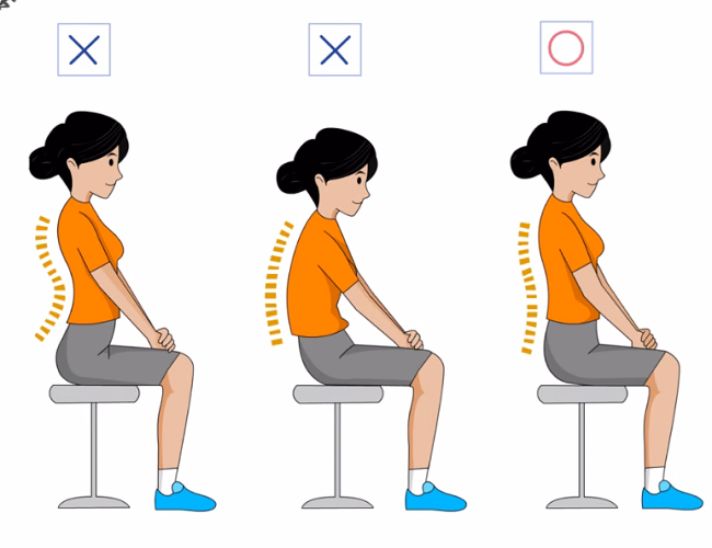 Hình ảnh mô phỏng tư thế gù lưng và sự biến dạng đường cong tự nhiên của cột sống ngực