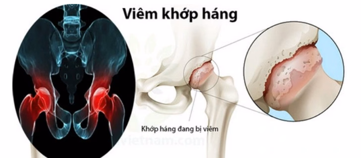 Bác sĩ nhi khoa đang thăm khám tầm vận động khớp háng và kiểm tra dáng đi khập khiễng của trẻ nhỏ