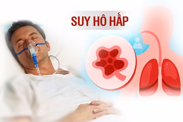 Bác sĩ chuyên khoa hô hấp đang kiểm tra chức năng phổi và nồng độ oxy máu cho người bệnh