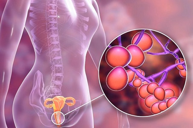 Bác sĩ chuyên khoa thăm khám và tư vấn điều trị nấm sinh dục cho người bệnh