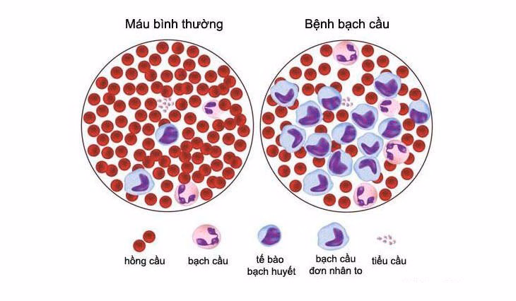 Bác sĩ giải thích kết quả xét nghiệm máu và hình thái tế bào máu cho bệnh nhân