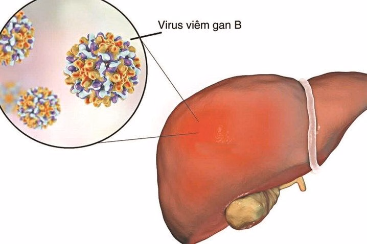 Cấu trúc hạt virus viêm gan B HBV và cơ chế xâm nhập tấn công tế bào gan