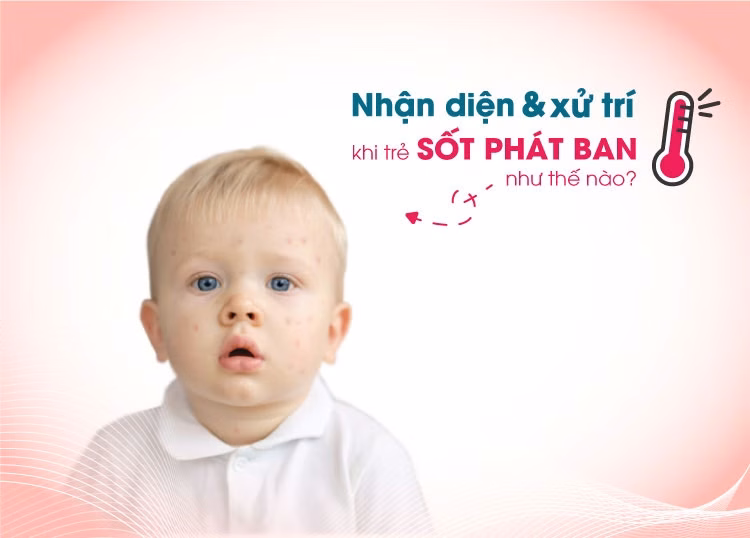 Trẻ nhỏ biểu hiện mệt mỏi trong giai đoạn sốt cao do bệnh sốt phát ban