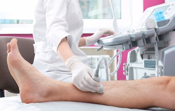 Bác sĩ thực hiện siêu âm Doppler mạch máu để chẩn đoán đau cách hồi