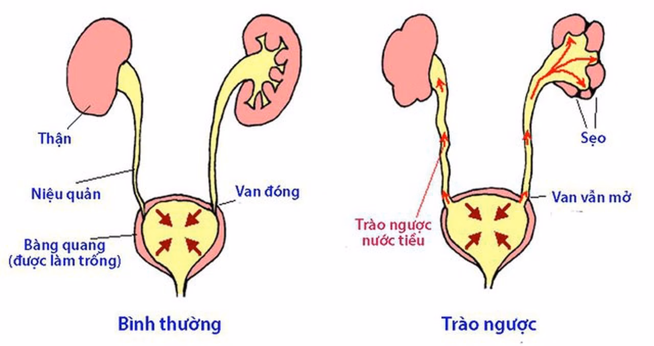 Bác sĩ chuyên khoa thăm khám và tư vấn sức khỏe hệ tiết niệu cho trẻ nhỏ
