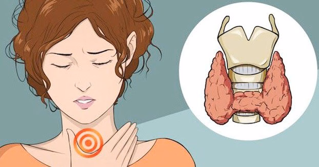 Hình ảnh minh họa vị trí tuyến giáp ở cổ và cảm giác đau tức khó chịu khi bị bệnh tuyến giáp