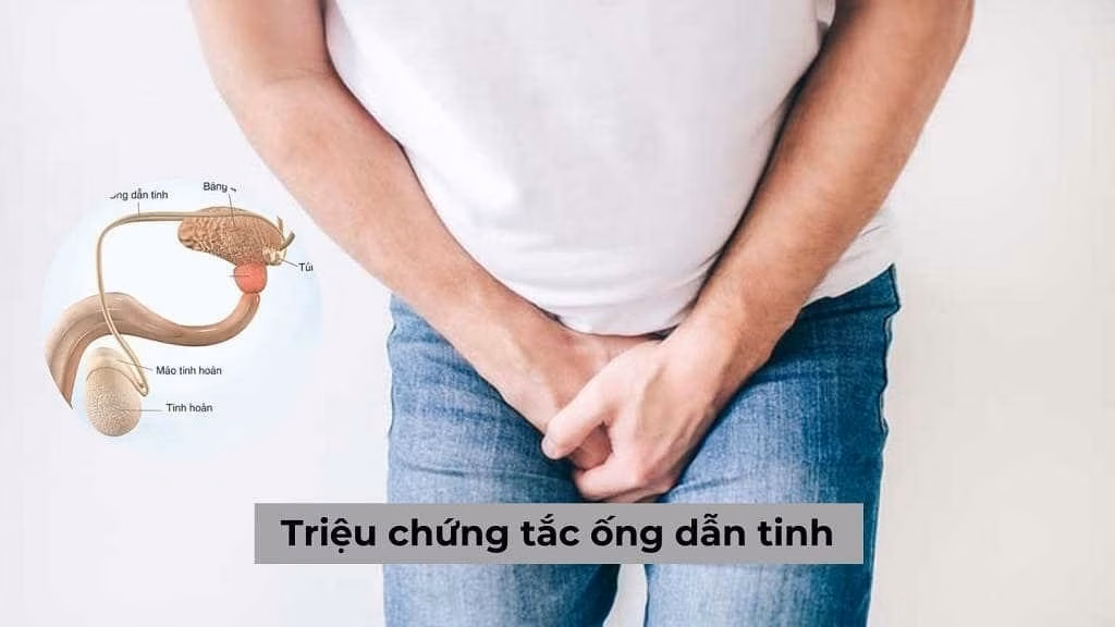Bác sĩ nam học tư vấn chẩn đoán tắc ống dẫn tinh và khả năng sinh sản cho bệnh nhân