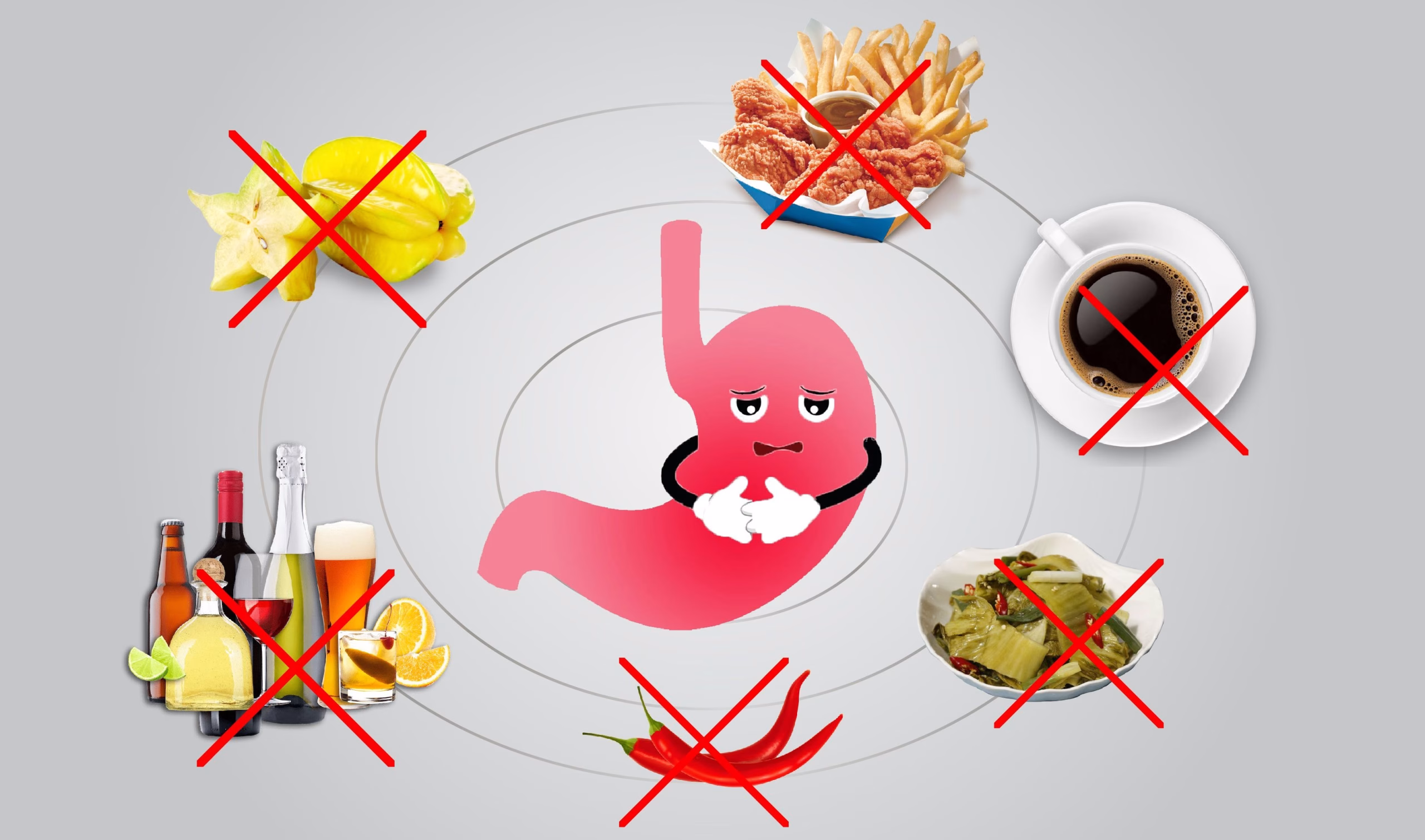 Sơ đồ cấu trúc giải phẫu vị trí môn vị nối giữa dạ dày và tá tràng cùng hiện tượng chít hẹp cản trở thức ăn