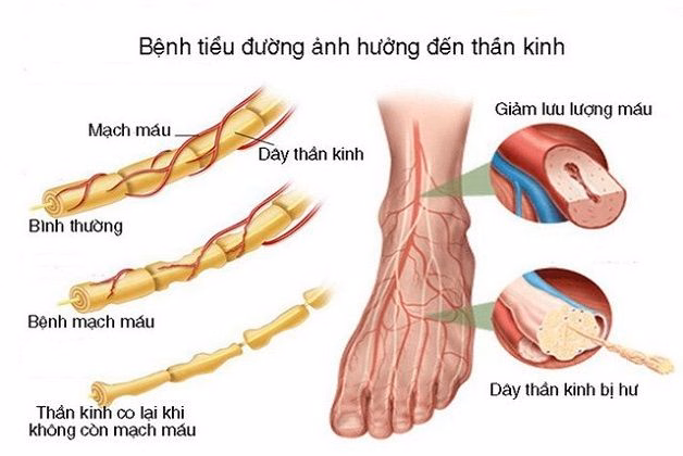 Bác sĩ chuyên khoa thần kinh đang tiến hành kiểm tra phản xạ vận động và cảm giác cho người bệnh
