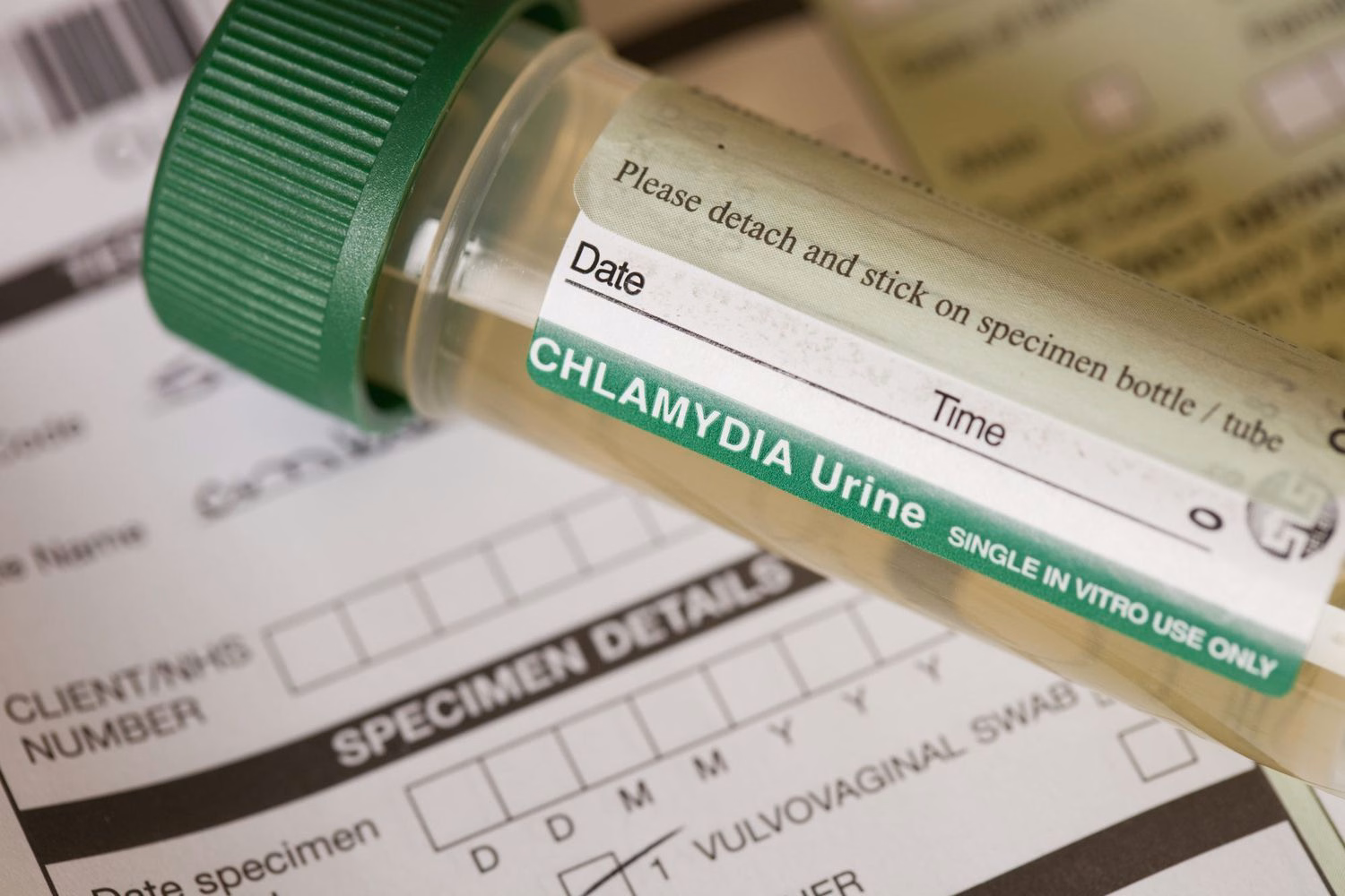 Bác sĩ chuyên khoa thực hiện lấy mẫu xét nghiệm tầm soát nhiễm khuẩn Chlamydia tại phòng khám