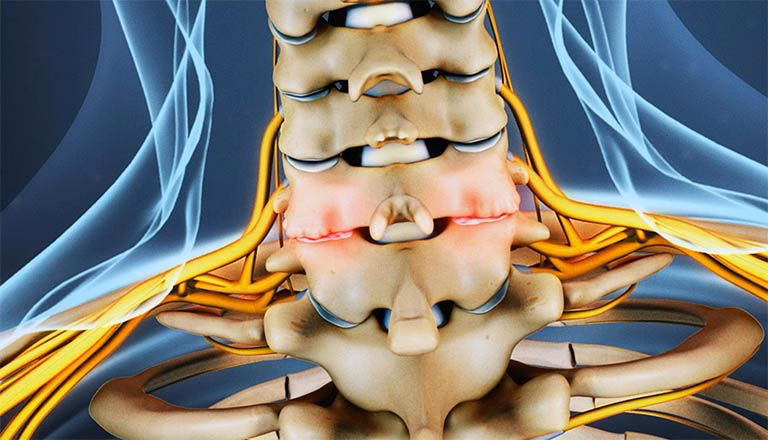 Bác sĩ chuyên khoa cơ xương khớp thăm khám vận động cổ và tư vấn cho người bệnh