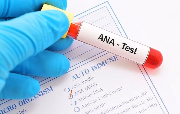 Bác sĩ thăm khám lâm sàng và tư vấn kế hoạch kiểm soát bệnh tự miễn cho người bệnh