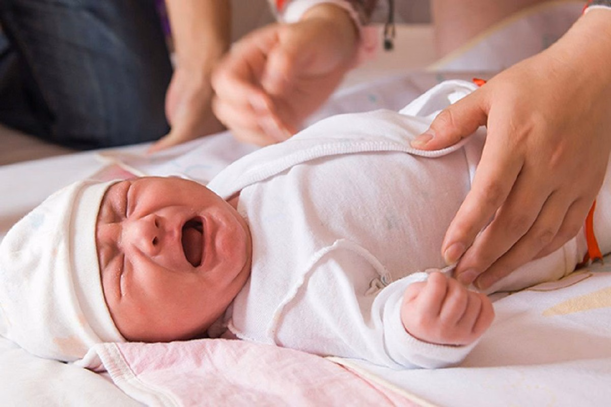 Hình ảnh mô phỏng vị trí tắc nghẽn đường tiêu hóa và teo ruột bẩm sinh ở trẻ sơ sinh