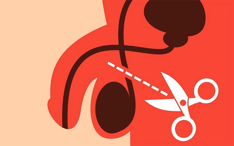 Bác sĩ chuyên khoa nam học tư vấn và giải thích quy trình thắt ống dẫn tinh cho người bệnh