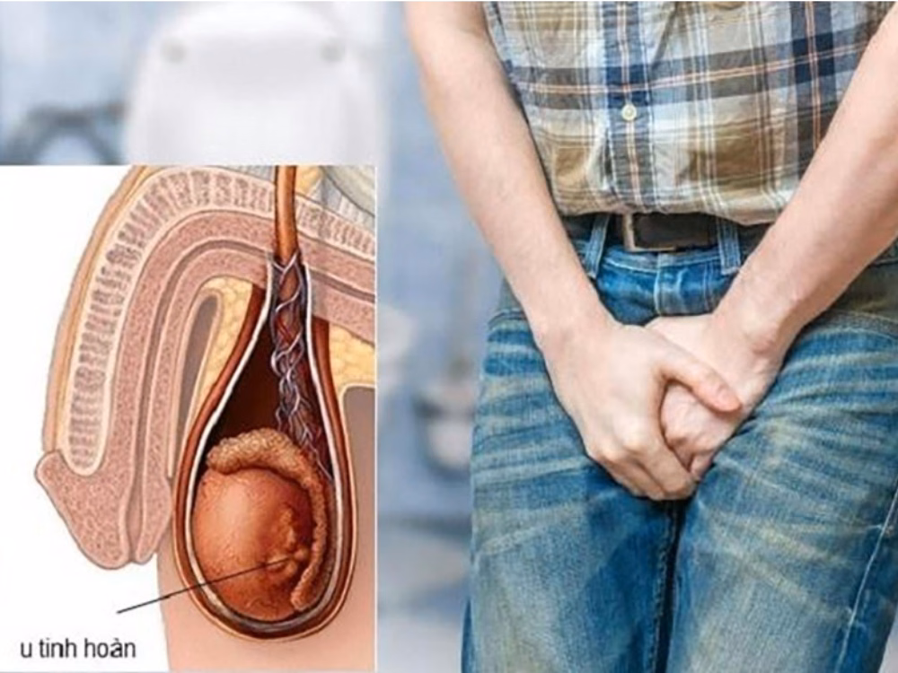 Hình ảnh hướng dẫn các bước tự kiểm tra vùng bìu và tinh hoàn định kỳ tại nhà