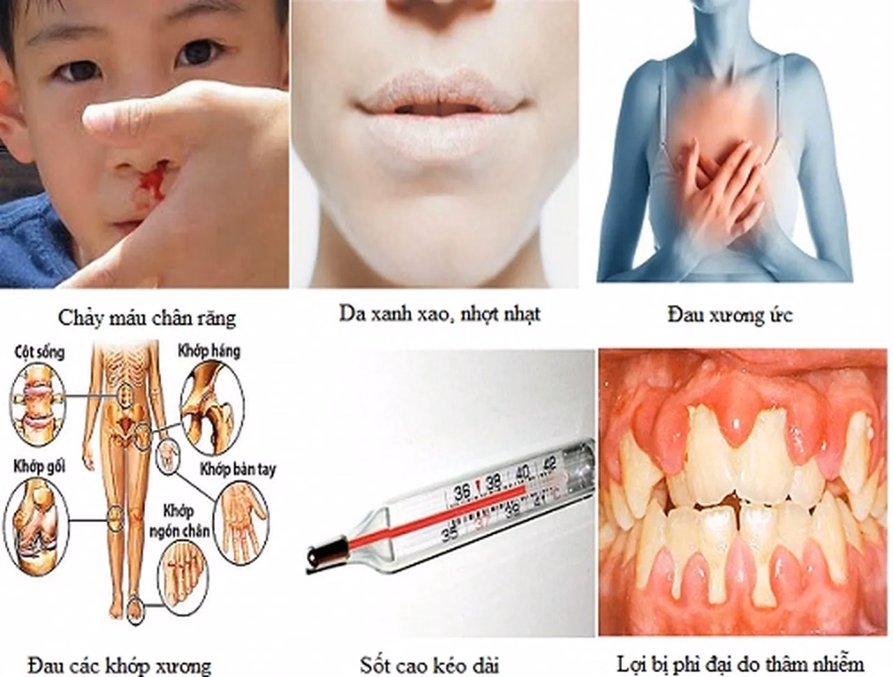 Hình ảnh minh họa các tế bào máu trong tủy xương gồm hồng cầu bạch cầu và tiểu cầu