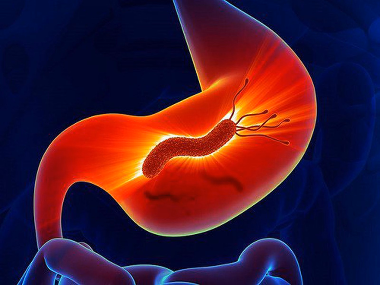 Mô phỏng 3D vi khuẩn Helicobacter pylori trong dạ dày gây viêm loét niêm mạc và đau bụng trên