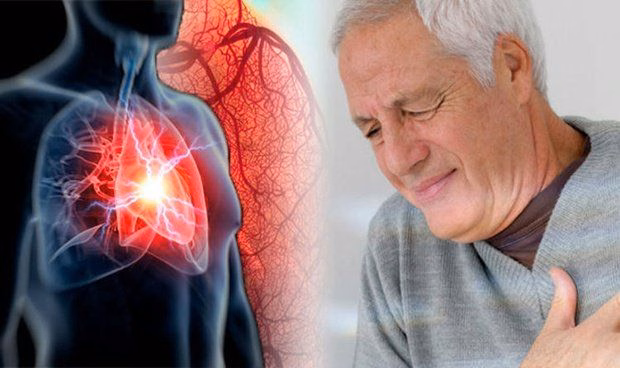 Hình ảnh chụp X-quang phổi phát hiện tổn thương thâm nhiễm phế nang lan tỏa