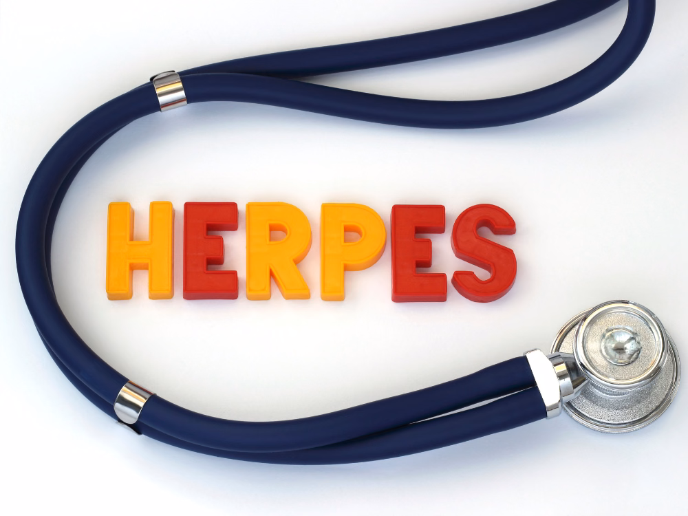 Bác sĩ chuyên khoa thăm khám và tư vấn kiểm soát bệnh herpes sinh dục cho người bệnh