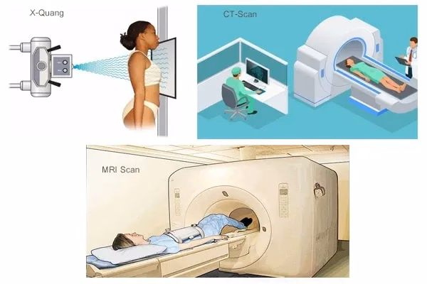 Các phương pháp chẩn đoán hình ảnh chấn thương cột sống gồm chụp X quang, chụp CT scan và chụp cộng hưởng từ MRI