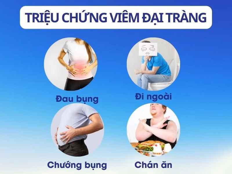 Sơ đồ các vị trí đau bụng thường gặp và các dấu hiệu rối loạn tiêu hóa điển hình ở bệnh nhân viêm đại tràng