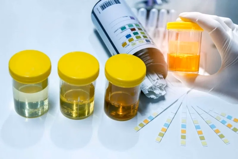 Bác sĩ chuyên khoa thực hiện siêu âm và thăm khám chức năng thận định kỳ cho bệnh nhi